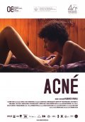 Acne film from Federico Veiroj filmography.